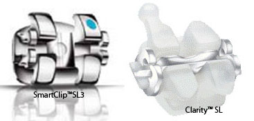 Clarity™-et-SmartClip™SL3-de-Unitek-Orthodontiste-Chamberland-Quebec