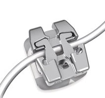 Lotus®Plus closed on wire-Ortho-Technology-orthodontiste-Chamberland-Quebec