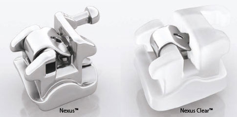 Nexus™-et-Nexus-Clear™-de-Ormco-orthodontiste-Chamberland-Quebec-web