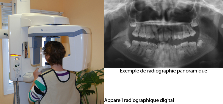 Prise-de-radio-panoramique-orthodontiste-Chamberland-Quebec
