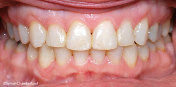http://www.sylvainchamberland.com/wp-content/uploads/2011/10/LoDeCh-iof-05102011-final-Orthodontiste-Chamberland-Quebec.jpg