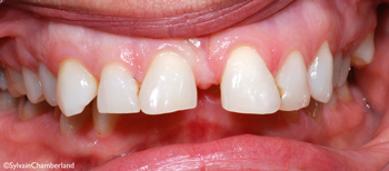 http://www.sylvainchamberland.com/wp-content/uploads/2011/10/LoDeCh-iof-160608-initial-Orthodontiste-Chamberland-Quebec.jpg
