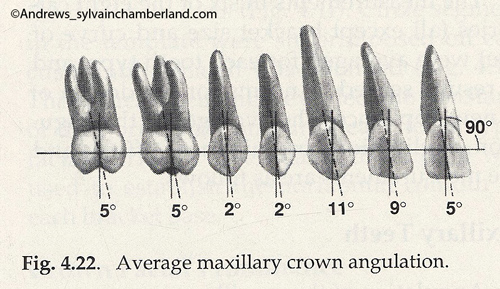 Angulations moyennes des couronnes-Dr Chamberland orthodontiste à Québec