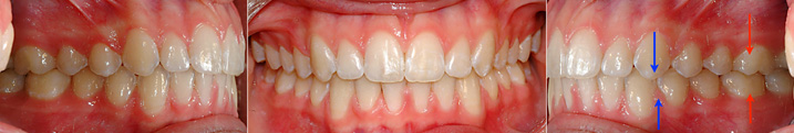 dentition
