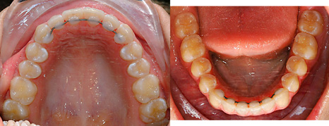 dentition