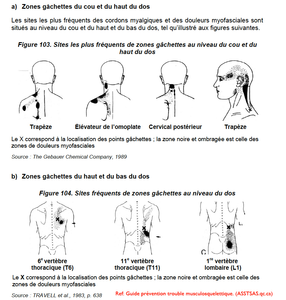 Trouble à l'articulation temporo-mandibulaire | Orthodontiste à Québec