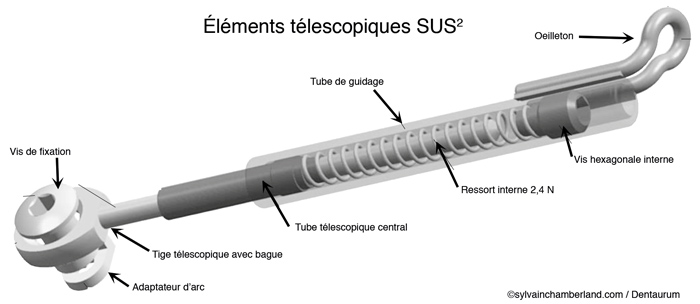 Éléments télescopiques du SUS2-Dr Chamberland orthodontiste à Québec