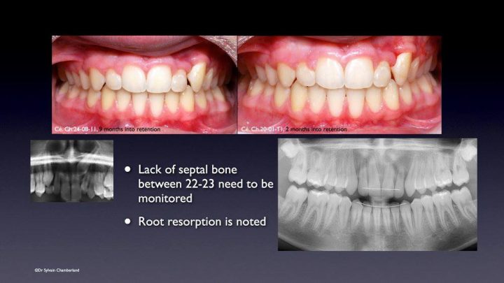 Actualité dentaire - Dr Sylvain Chamberland, Orthodontiste